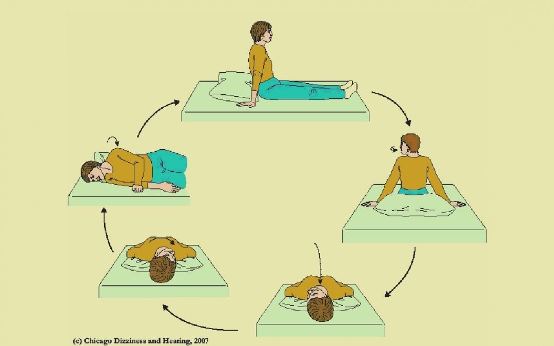Vestibular Exercises - exercise sheet 1 of 3
