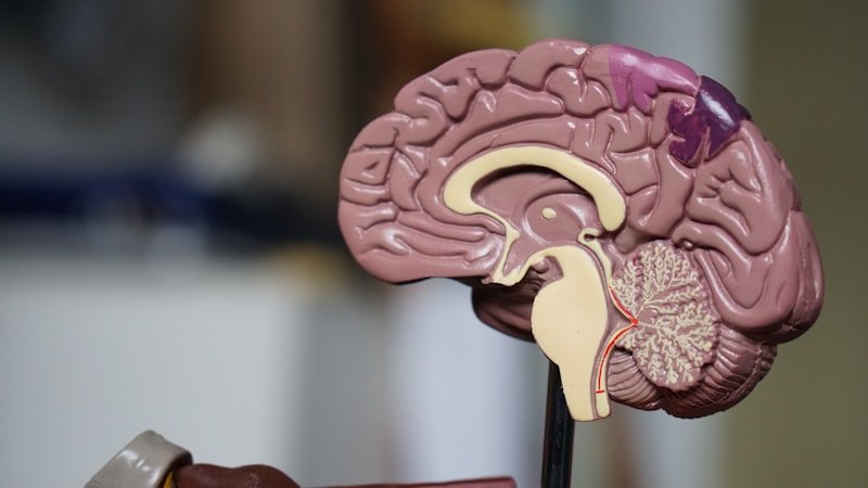 An anatomical model of the human brain